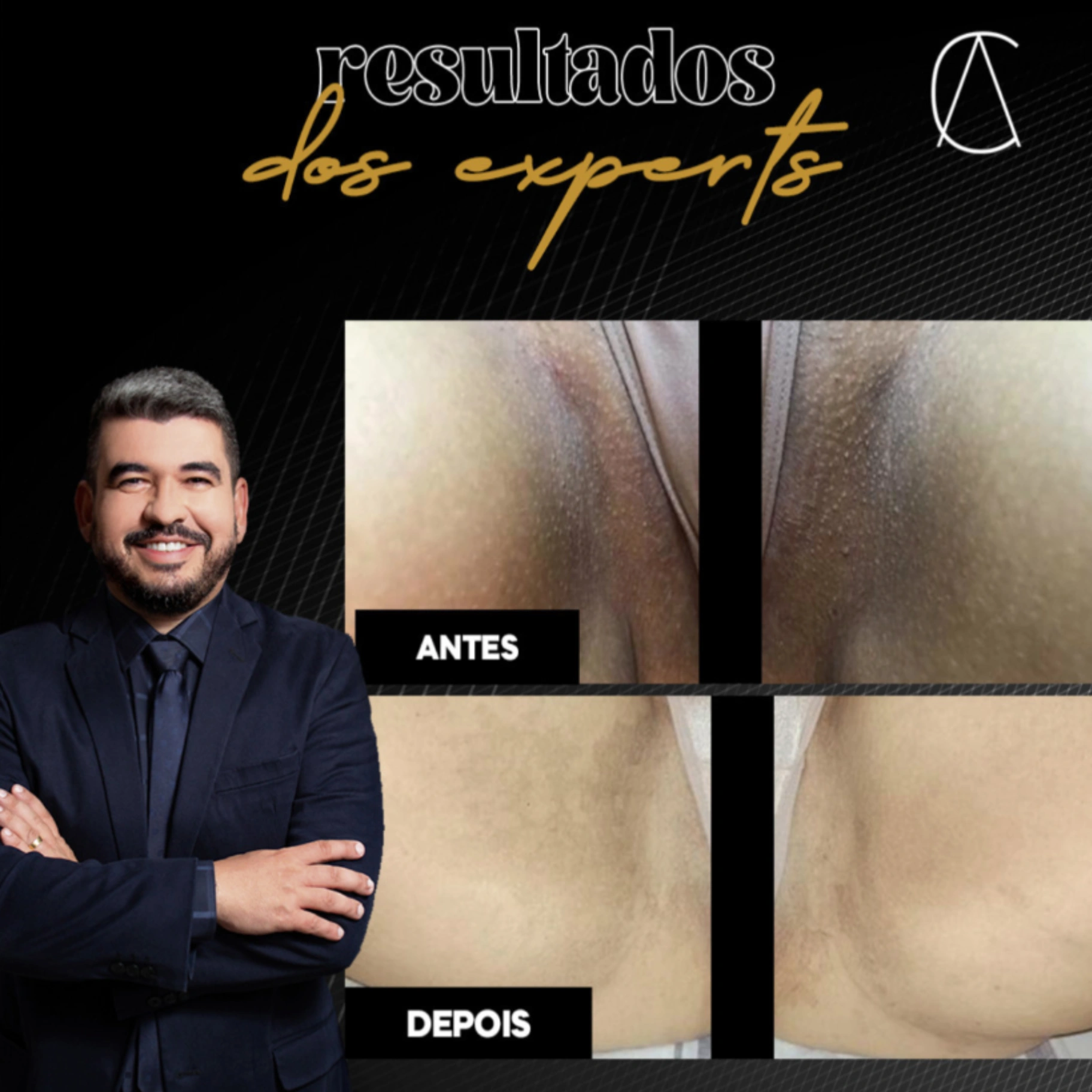 Caso real — Resultados de los experts
