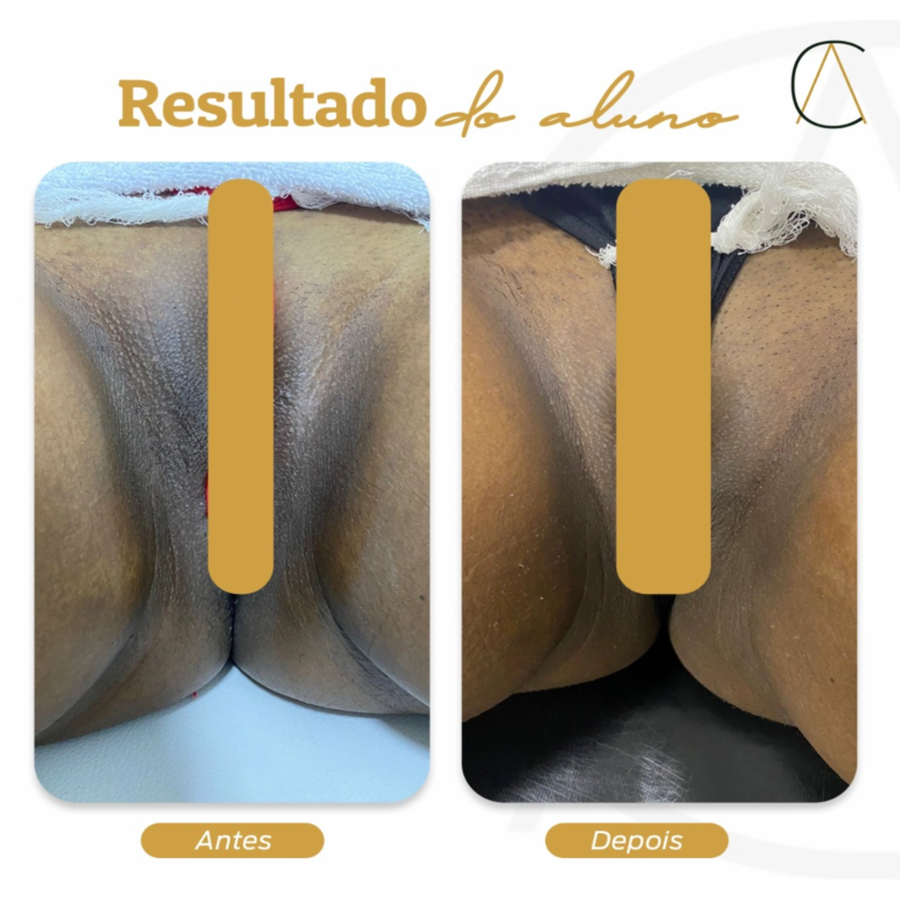 Caso real — Resultado del alumno